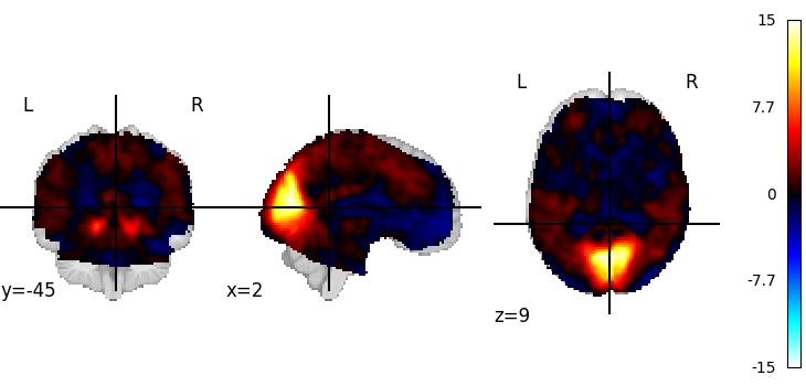 plot 3d and 4d niimg