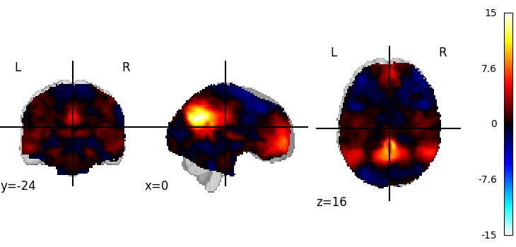 plot 3d and 4d niimg