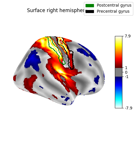 Surface right hemisphere