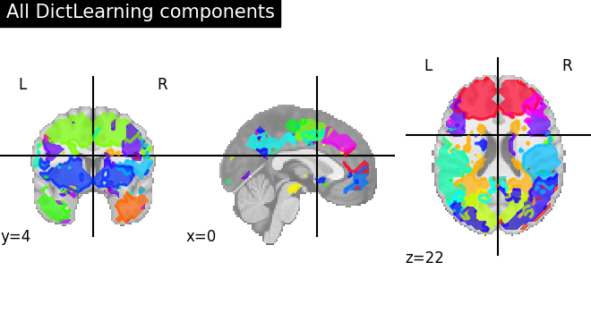 ../_images/sphx_glr_plot_compare_decomposition_022.png