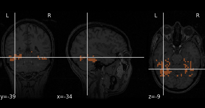 _images/sphx_glr_plot_decoding_tutorial_001.png