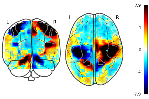 plot demo glass brain extensive