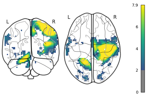 plot demo glass brain extensive