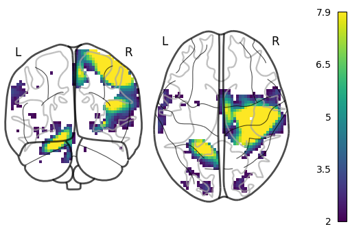 plot demo glass brain extensive