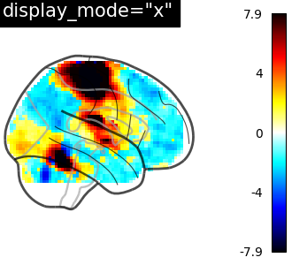 plot demo glass brain extensive