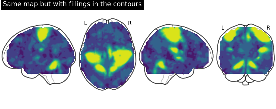 plot demo glass brain extensive