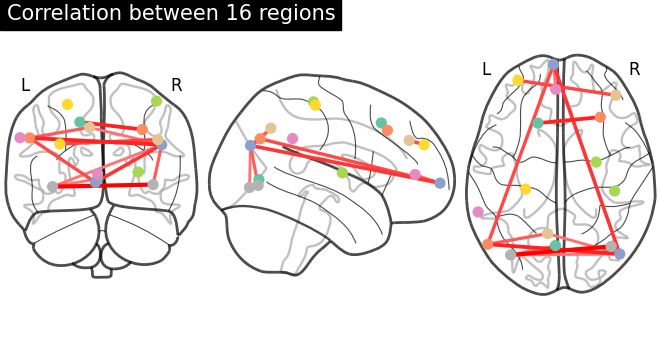 plot extract regions dictlearning maps