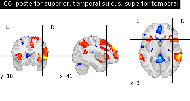 plot ica neurovault