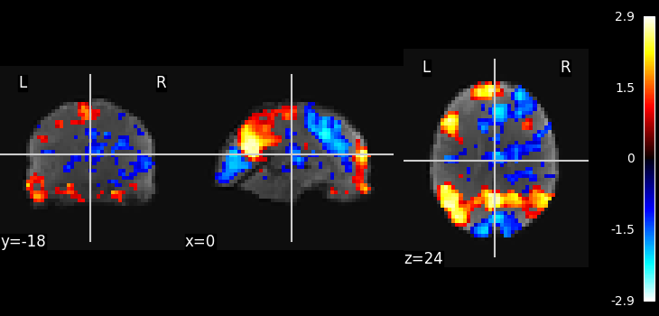 plot ica resting state