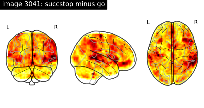 plot neurovault meta analysis