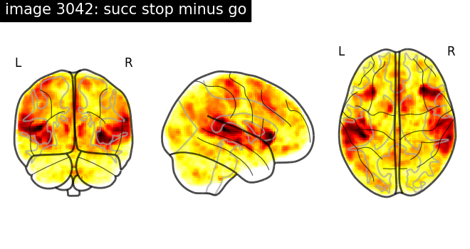 plot neurovault meta analysis