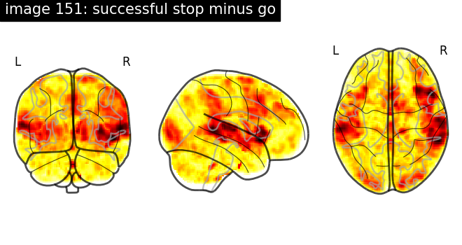 plot neurovault meta analysis