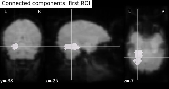 plot roi extraction