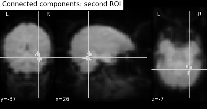 plot roi extraction