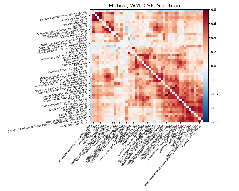 Motion, WM, CSF, Scrubbing