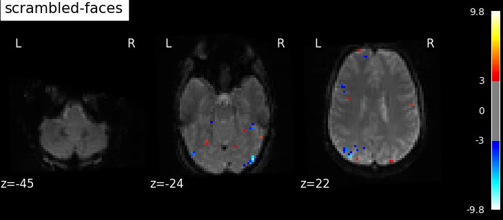 plot spm multimodal faces