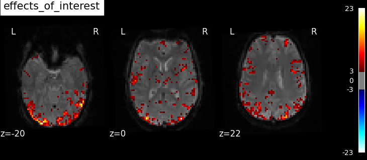 plot spm multimodal faces