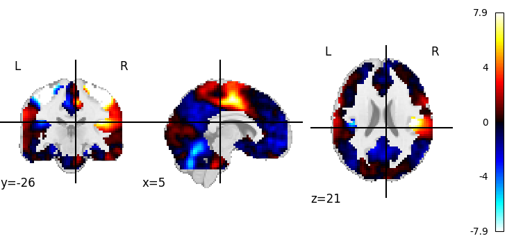 plot 3d and 4d niimg