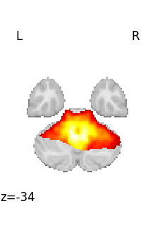 plot 3d and 4d niimg