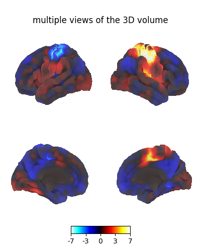 multiple views of the 3D volume