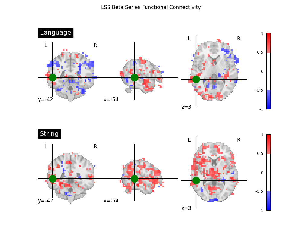 LSS Beta Series Functional Connectivity