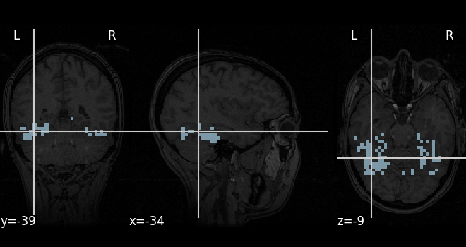 _images/sphx_glr_plot_decoding_tutorial_001.png