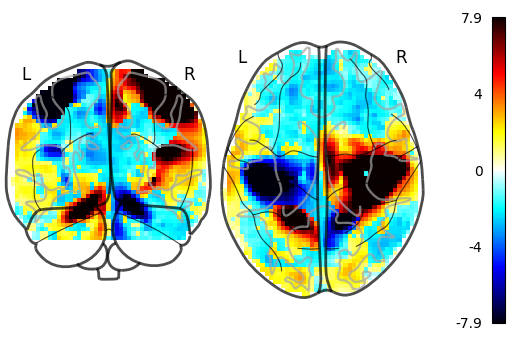 plot demo glass brain extensive