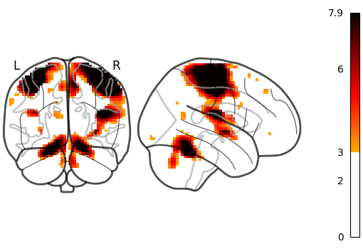 plot demo glass brain extensive