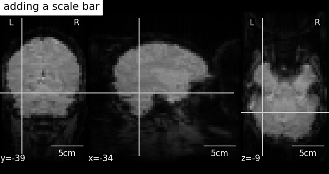 plot_scalebar