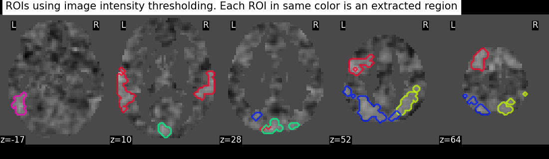 plot extract rois statistical maps