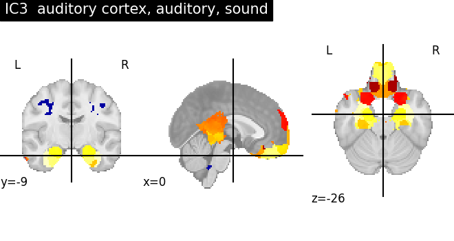 plot ica neurovault