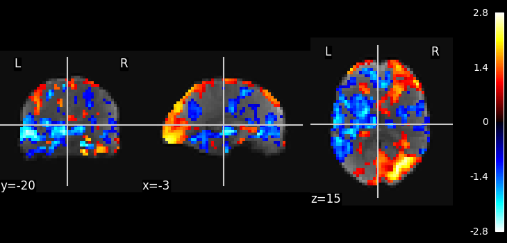 plot ica resting state