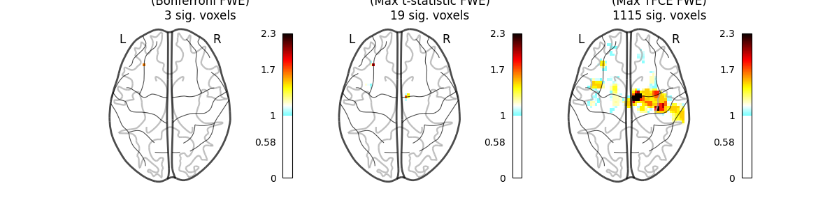 Group left button press ($-\log_{10}$ p-values), Parametric Test (Bonferroni FWE) 3 sig. voxels, Permutation Test (Max t-statistic FWE) 19 sig. voxels, Permutation Test (Max TFCE FWE) 1115 sig. voxels