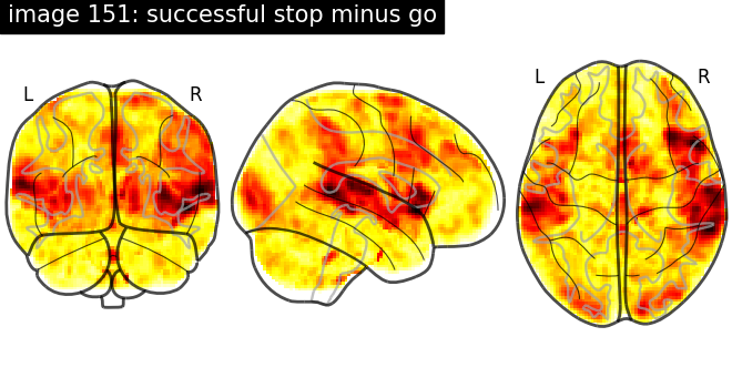 plot neurovault meta analysis