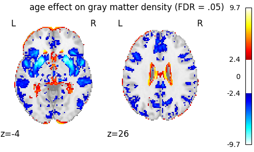 age effect on gray matter density (FDR = .05)