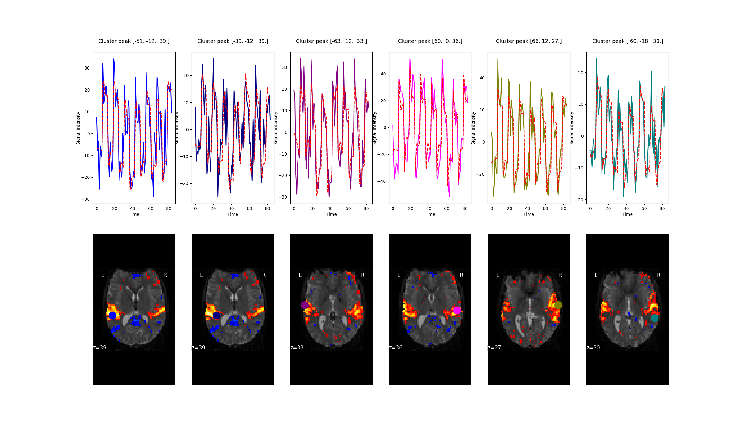 Cluster peak [-51. -12.  39.] , Cluster peak [-39. -12.  39.] , Cluster peak [-63.  12.  33.] , Cluster peak [60.  0. 36.] , Cluster peak [66. 12. 27.] , Cluster peak [ 60. -18.  30.]