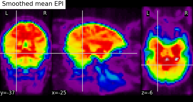 plot roi extraction