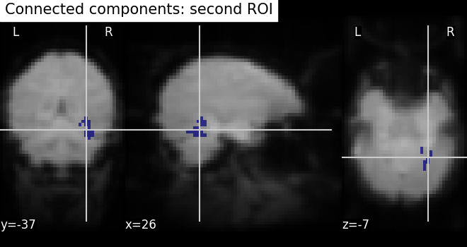 plot roi extraction