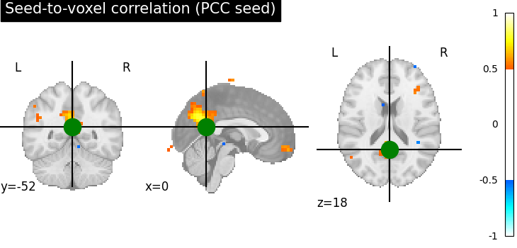 plot seed to voxel correlation