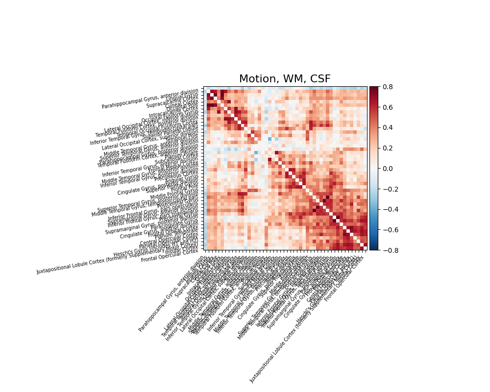 Motion, WM, CSF