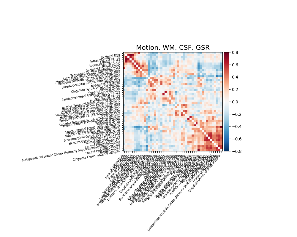 Motion, WM, CSF, GSR