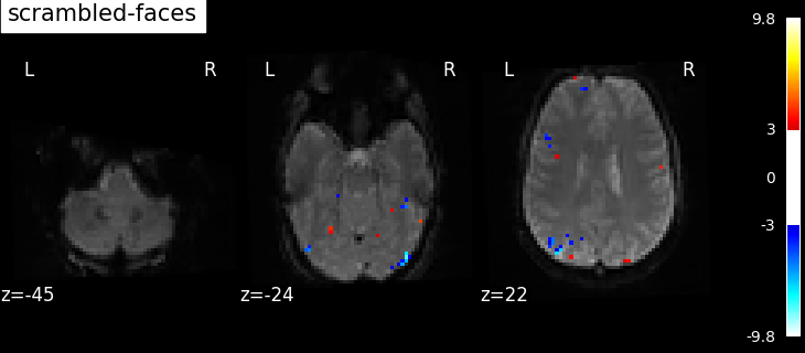 plot spm multimodal faces