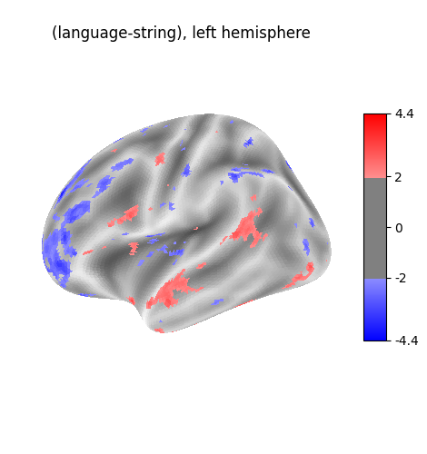 (language-string), left hemisphere