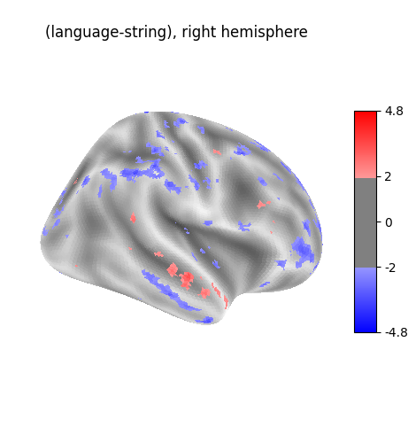 (language-string), right hemisphere