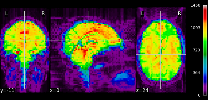 plot visualization