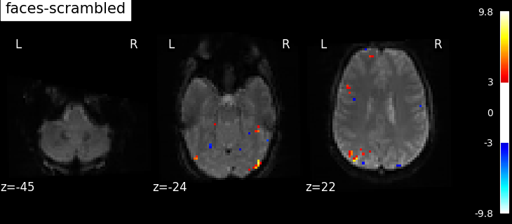 ../_images/sphx_glr_plot_spm_multimodal_faces_001.png