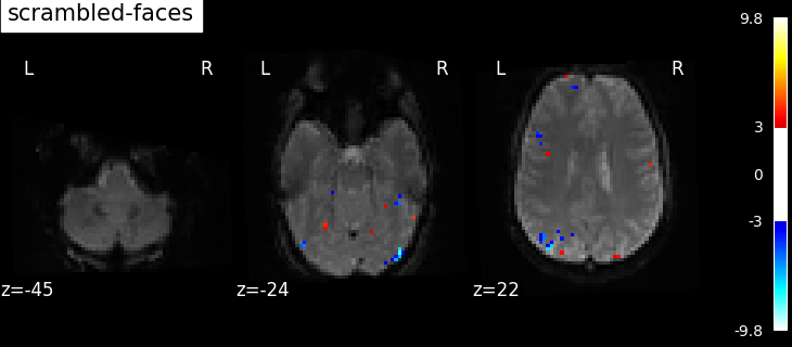 ../_images/sphx_glr_plot_spm_multimodal_faces_002.png