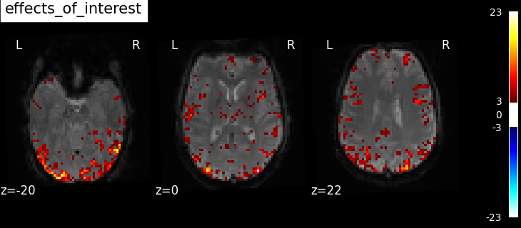 ../_images/sphx_glr_plot_spm_multimodal_faces_003.png
