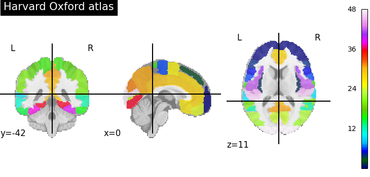 ../_images/sphx_glr_plot_atlas_001.png