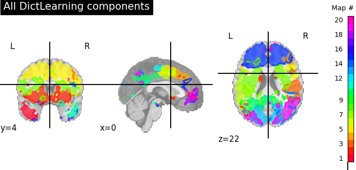 plot compare decomposition